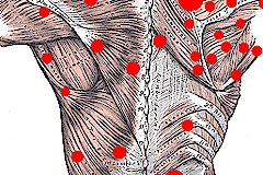 Myofascial